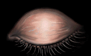 Blinking Eyeball
